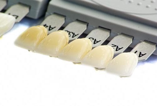 AN INTRODUCTION TO SURGICAL GUIDE IN DENTISTRY